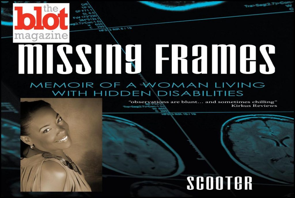 Missing Frames, Revelation of Unknown Traumatic Brain Injury Could Be You