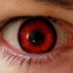 Man Overdosed on Viagra, Gets Permanently Red Tinged Vision