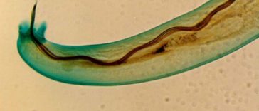 Reports of Three More Cases of Brain Burrowing Parasitic Worms in Hawaii