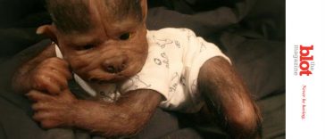 17 Babies in Spain Get Werewolf Syndrome After Drug Error