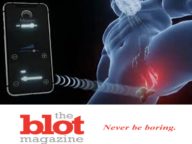 Taint Bandaid Is Now Something You Can Buy, Perineum Depending