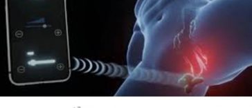 Taint Bandaid Is Now Something You Can Buy, Perineum Depending