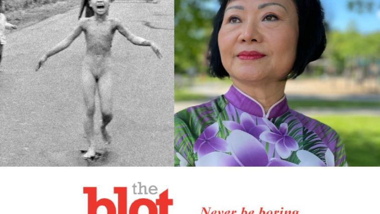 Napalm Girl Kim Phuc Gets Final Burn Treatment Over 50 Years in Florida