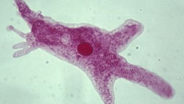 6 Symptoms That Could Show You Have Brain-Eating Amoeba