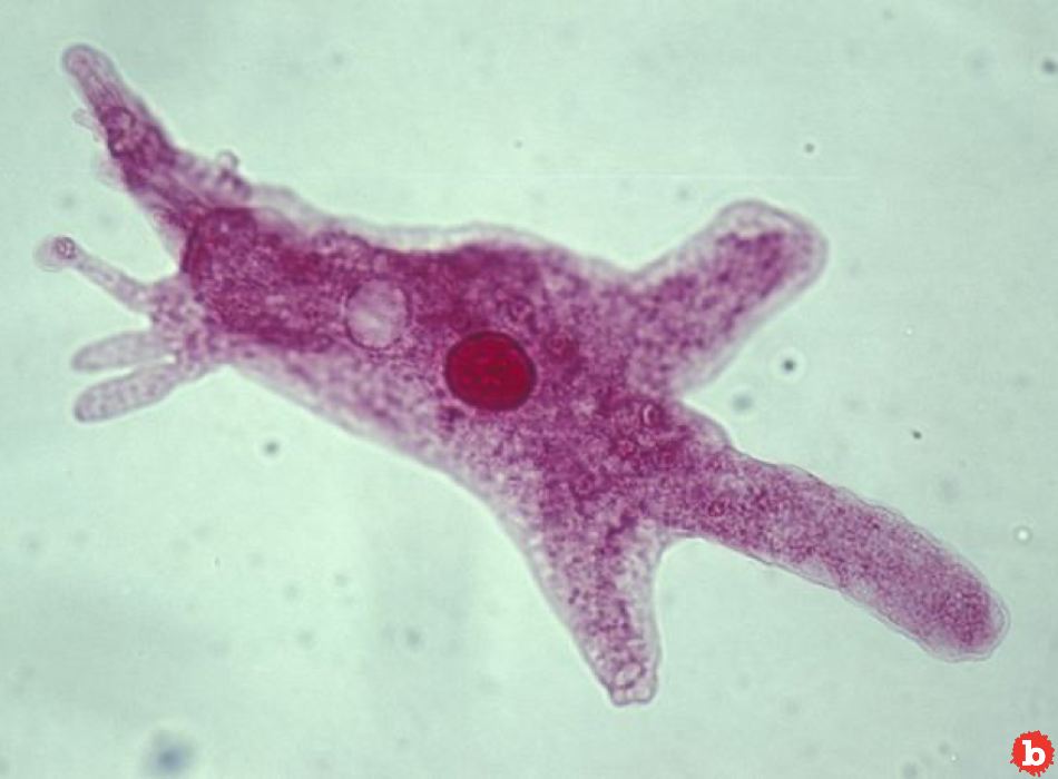 6 Symptoms That Could Show You Have Brain-Eating Amoeba