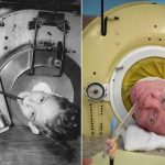 After Living 70 Years In An Iron Lung, Polio Survivor Dies of Covid